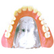 コバルト床義歯
